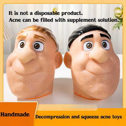 Eco-Friendly Reusable Realistic Acne Popping Stress Relief Toy Big Head Pimple Squeezer